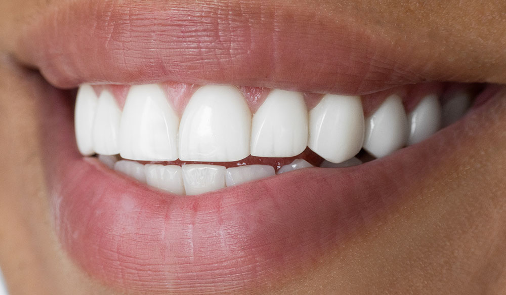 big white smile lips